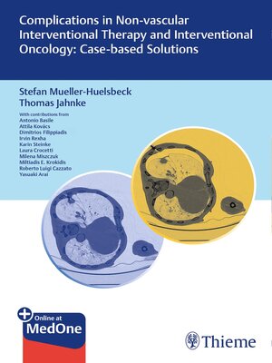 cover image of Complications in Non-vascular Interventional Therapy and Interventional Oncology
